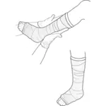 Illustration vectorielle de l'examen de la jambe plâtrée