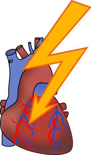 Symbool voor hartaanval vector tekening