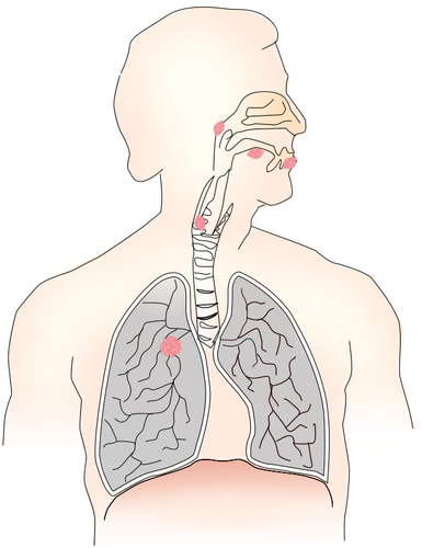 Simbolo per immagine vettoriale di cancro del polmone