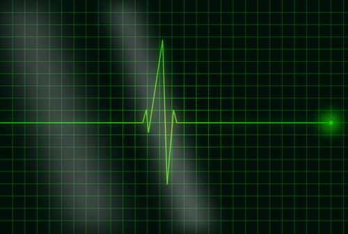 Vector image of electrocardiogram