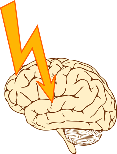 Grafika wektorowa udaru mózgu