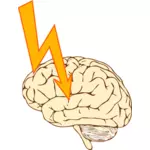 Grafika wektorowa udaru mózgu