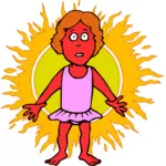 Mujer quemada por el sol