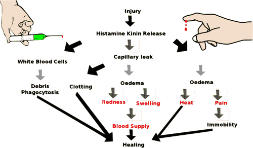 Peradangan skema vektor gambar