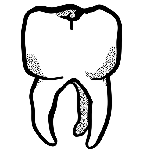 Tooth