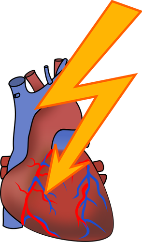 Symbol for heart attack vector drawing