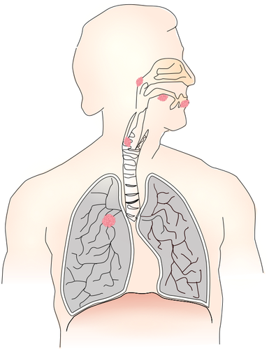 Symbol grafika wektorowa raka płuc