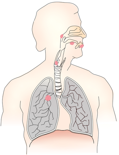 Symbol for lung cancer vector image