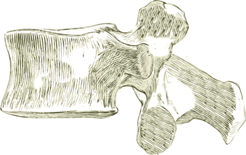 Lumbar bones