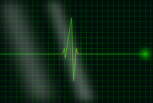 Vector afbeelding van elektrocardiogram