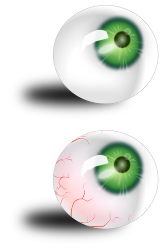 Grønne øyeeplet