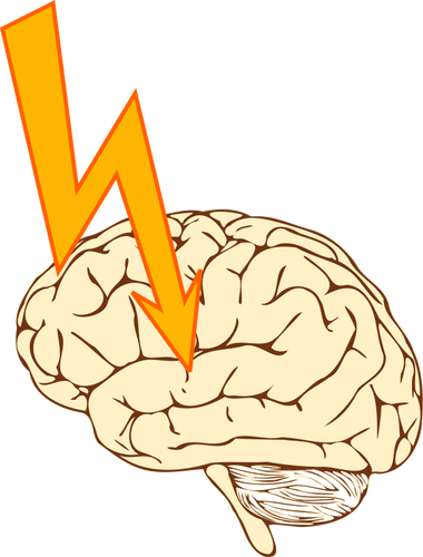 Vector image of stroke