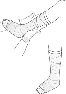 Ilustraţia vectorială de picior exprimate de examinare