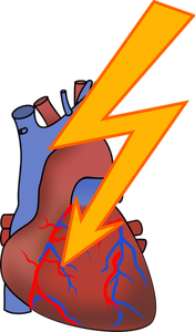 Simbolo per il disegno vettoriale di attacco di cuore