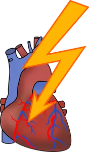 Sydänkohtausvektoripiirroksen symboli