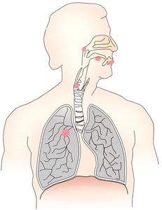 Symbol for lung cancer vector image