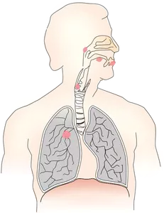 Keuhkosyövän vektorikuvan symboli