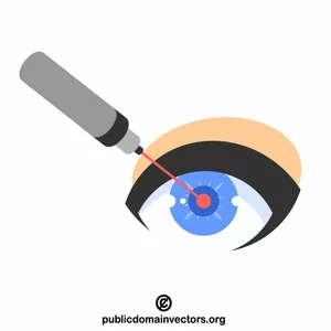 Correzione laser dell'occhio