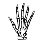 Рука рентгеновские