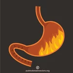 État de santé des brûlures d'estomac