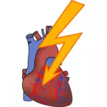 Symbol for heart attack vector drawing