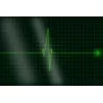 Imagine vectorială de electrocardiogramă